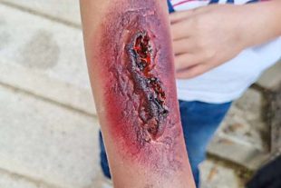 2021-9-22-NO-Sommerferienprogr-JRK_Nordrach_Erste Hilfe-1